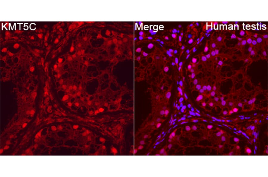 Immunofluorescence - Anti-SUV4-20h2 Antibody (A329551) - Antibodies.com