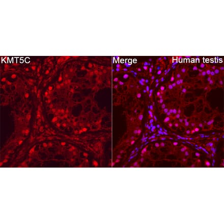 Immunofluorescence - Anti-SUV4-20h2 Antibody (A329551) - Antibodies.com