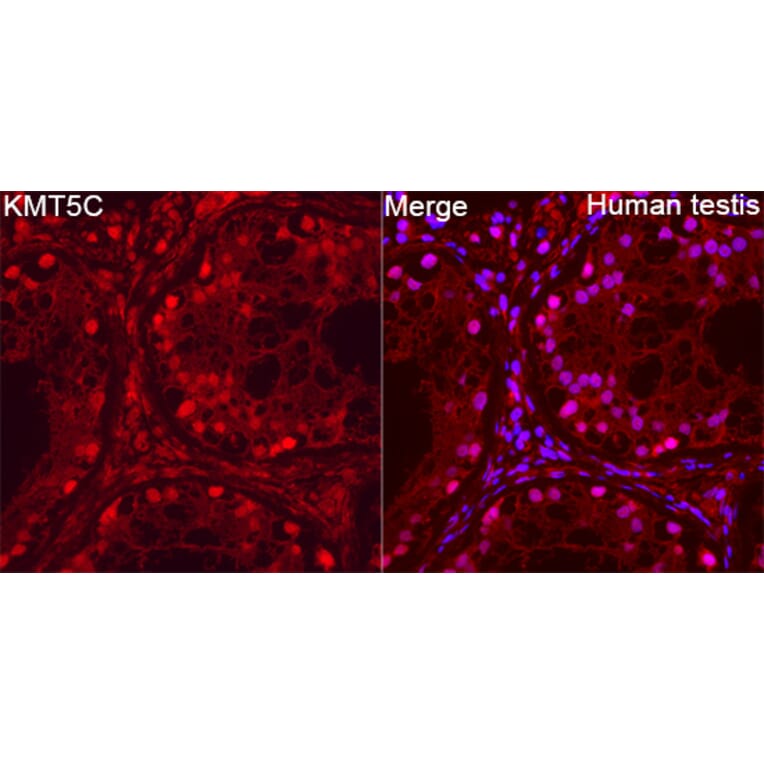 Immunofluorescence - Anti-SUV4-20h2 Antibody (A329551) - Antibodies.com