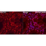 Immunofluorescence - Anti-SUV4-20h2 Antibody (A329551) - Antibodies.com