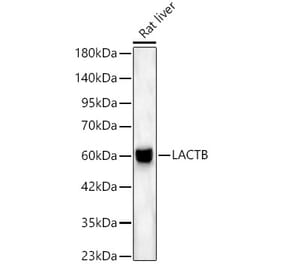 Western Blot - Anti-LACTB Antibody (A329554) - Antibodies.com