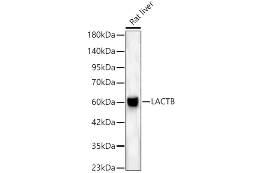 Western Blot - Anti-LACTB Antibody (A329554) - Antibodies.com