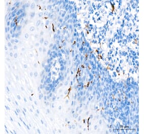 Immunohistochemistry - Anti-Langerin Antibody (A329556) - Antibodies.com