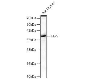 Western Blot - Anti-LAP2 Antibody (A329557) - Antibodies.com