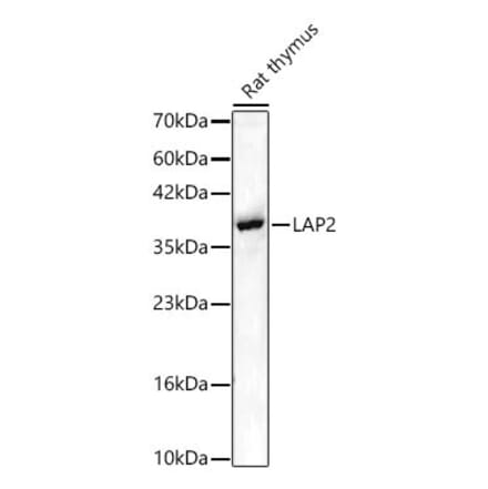 Western Blot - Anti-LAP2 Antibody (A329557) - Antibodies.com