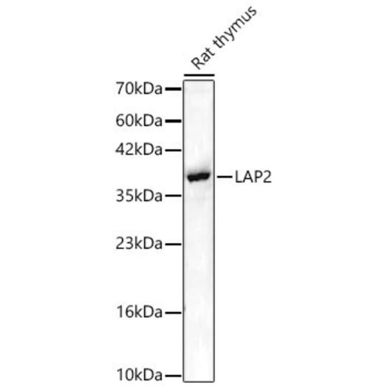 Western Blot - Anti-LAP2 Antibody (A329557) - Antibodies.com