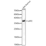Western Blot - Anti-LAP2 Antibody (A329557) - Antibodies.com
