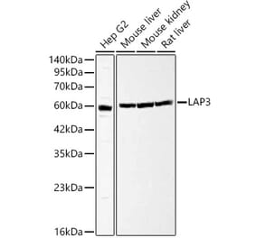 Western Blot - Anti-LAP3 Antibody (A329558) - Antibodies.com