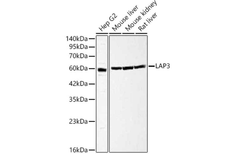 Western Blot - Anti-LAP3 Antibody (A329558) - Antibodies.com