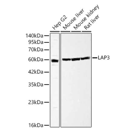 Western Blot - Anti-LAP3 Antibody (A329558) - Antibodies.com