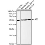 Western Blot - Anti-LAP3 Antibody (A329558) - Antibodies.com