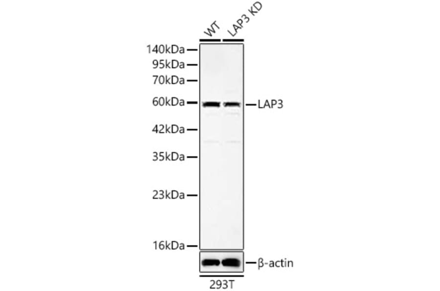 Western Blot - Anti-LAP3 Antibody (A329558) - Antibodies.com