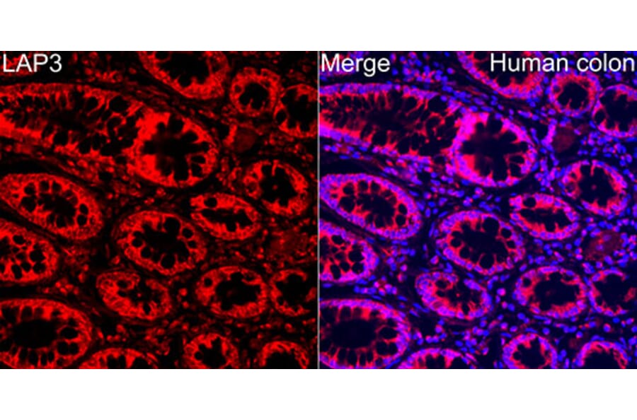 Immunofluorescence - Anti-LAP3 Antibody (A329558) - Antibodies.com