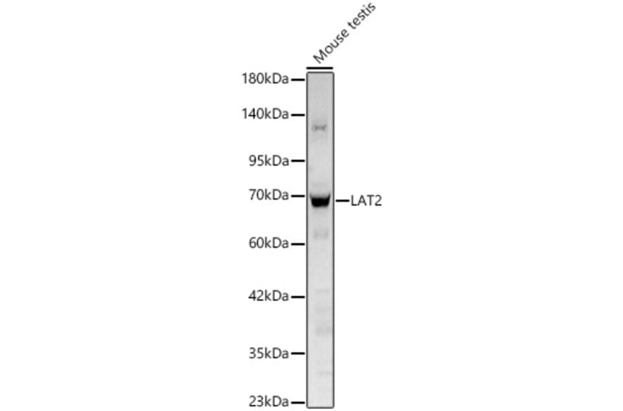 Western Blot - Anti-LAT2 Antibody (A329559) - Antibodies.com