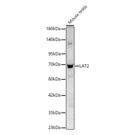 Western Blot - Anti-LAT2 Antibody (A329559) - Antibodies.com