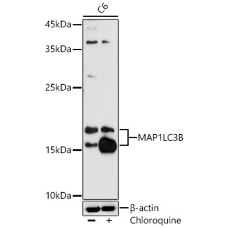 Western Blot - Anti-LC3B Antibody (A329560) - Antibodies.com