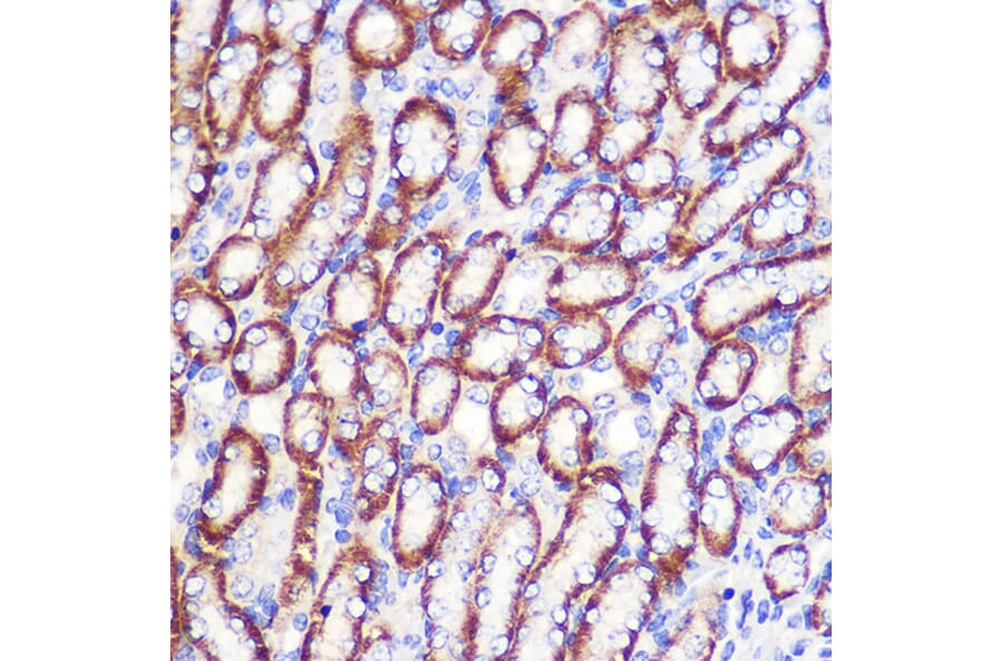 Immunohistochemistry - Anti-LDHA Antibody (A329561) - Antibodies.com