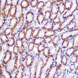 Immunohistochemistry - Anti-LDHA Antibody (A329561) - Antibodies.com
