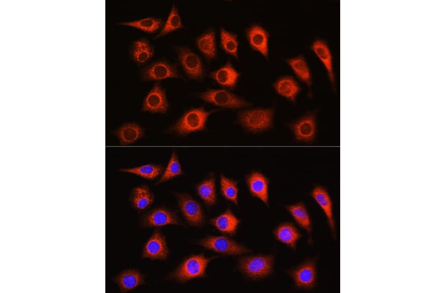 Immunofluorescence - Anti-LDHA Antibody (A329561) - Antibodies.com
