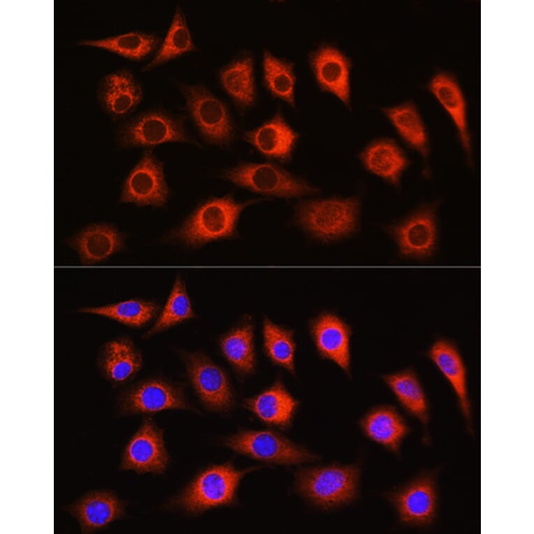 Immunofluorescence - Anti-LDHA Antibody (A329561) - Antibodies.com