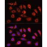 Immunofluorescence - Anti-LDHA Antibody (A329561) - Antibodies.com