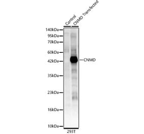 Western Blot - Anti-LECT1 Antibody (A329562) - Antibodies.com