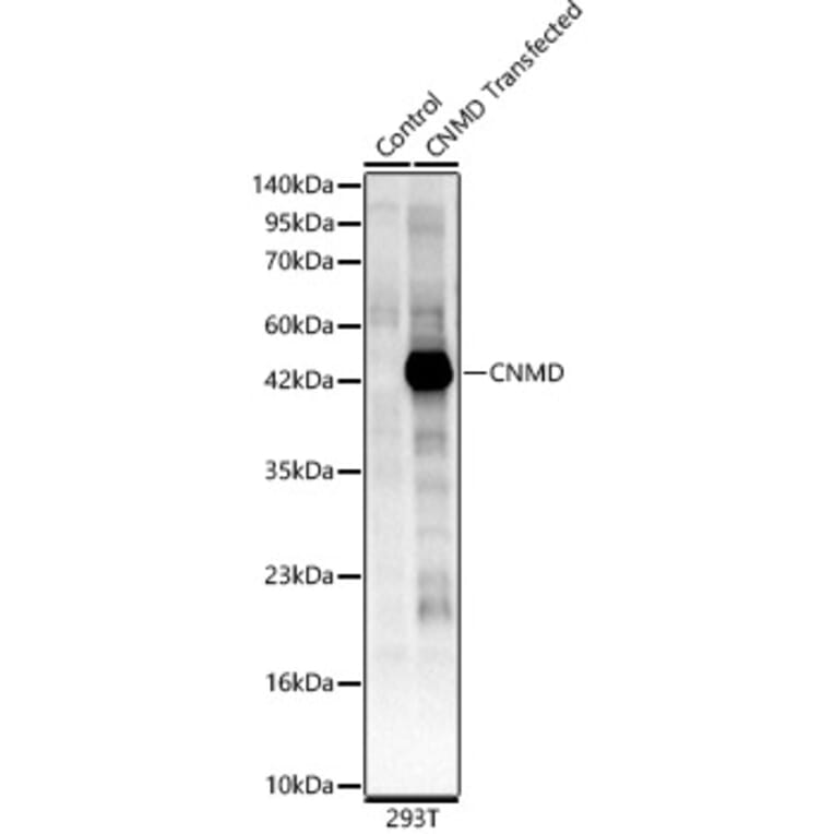 Western Blot - Anti-LECT1 Antibody (A329562) - Antibodies.com