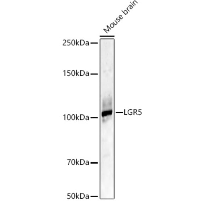 Western Blot - Anti-LGR5 Antibody (A329565) - Antibodies.com