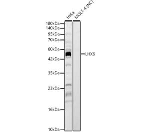 Western Blot - Anti-LHX6 Antibody (A329566) - Antibodies.com