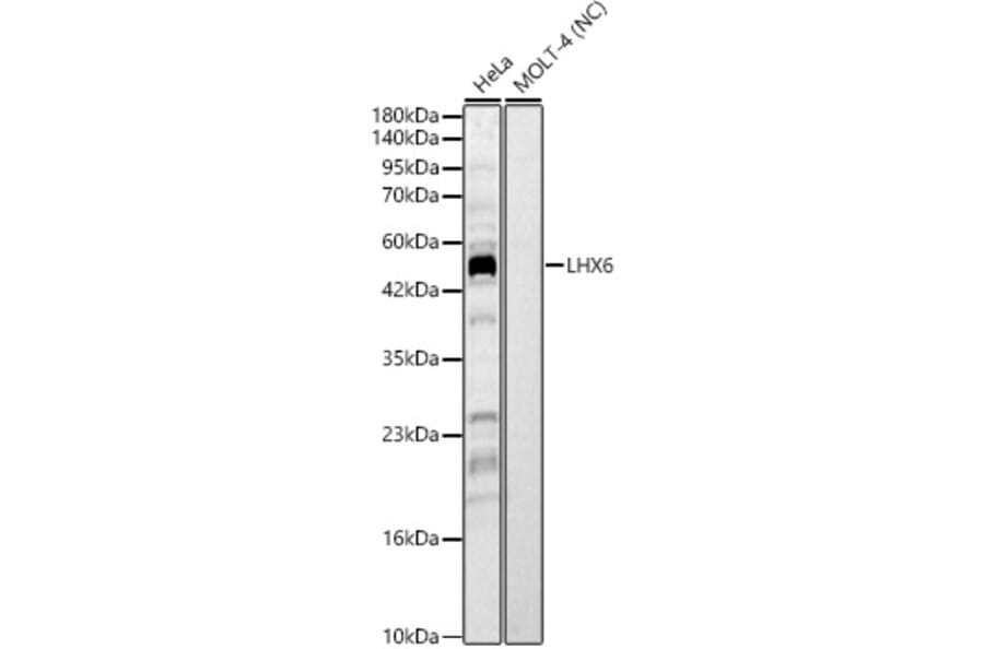 Western Blot - Anti-LHX6 Antibody (A329566) - Antibodies.com