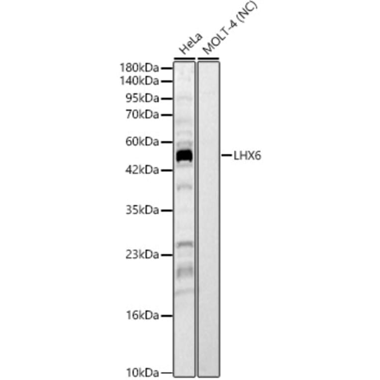 Western Blot - Anti-LHX6 Antibody (A329566) - Antibodies.com