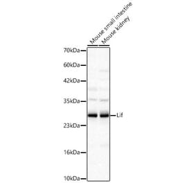 Western Blot - Anti-LIF Antibody (A329567) - Antibodies.com