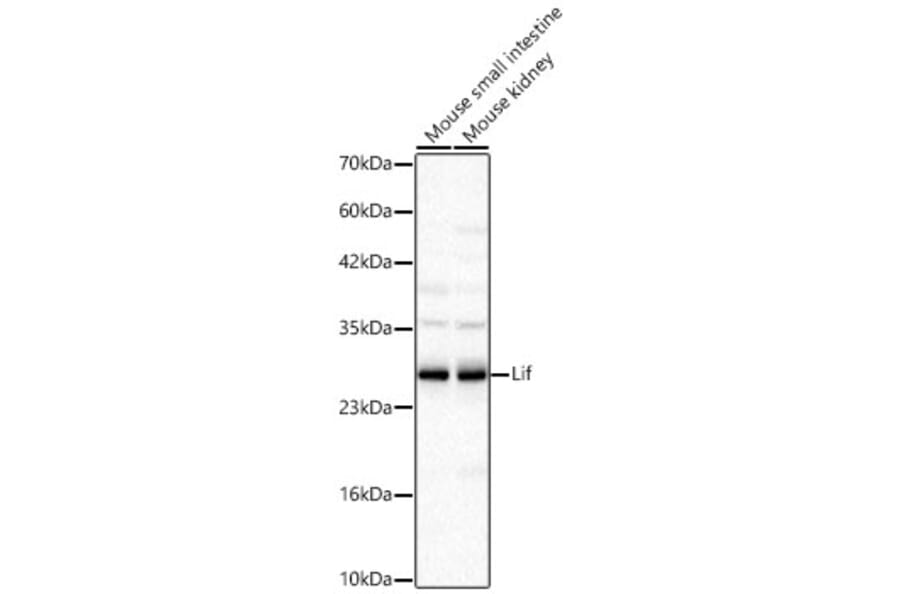 Western Blot - Anti-LIF Antibody (A329567) - Antibodies.com