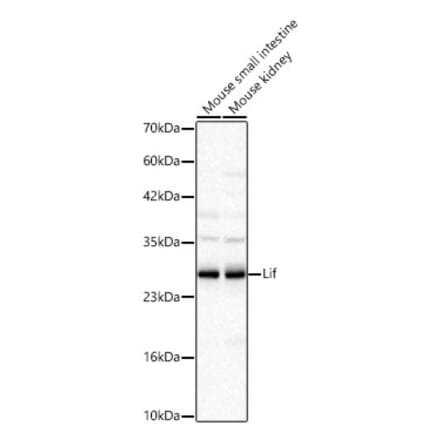 Western Blot - Anti-LIF Antibody (A329567) - Antibodies.com