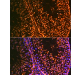 Immunofluorescence - Anti-LIN28A Antibody [ARC1668] (A329570) - Antibodies.com