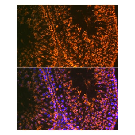 Immunofluorescence - Anti-LIN28A Antibody [ARC1668] (A329570) - Antibodies.com