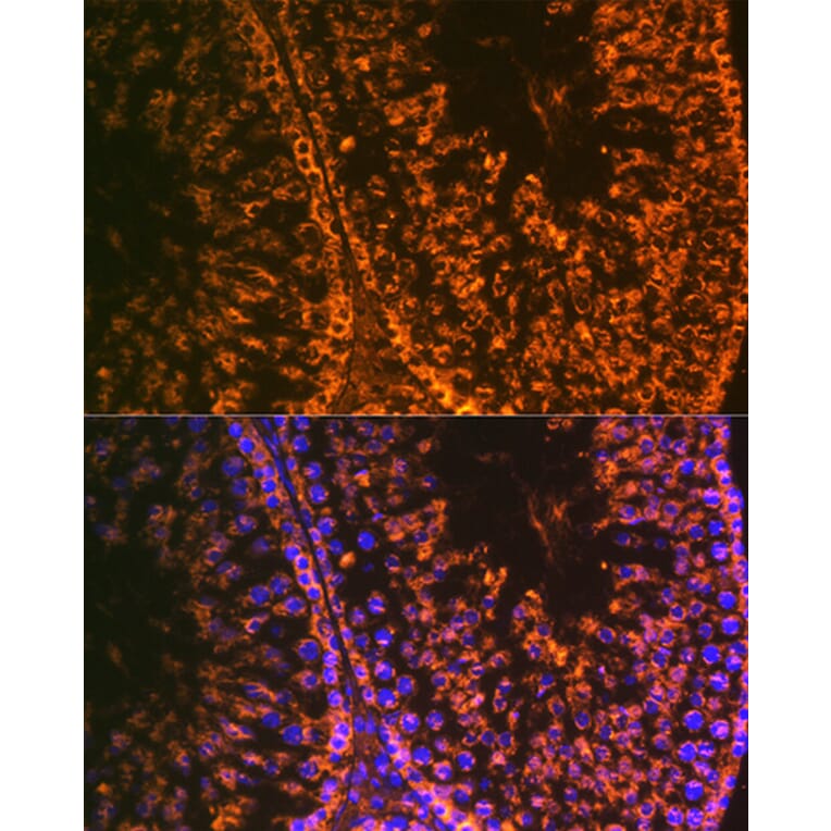 Immunofluorescence - Anti-LIN28A Antibody [ARC1668] (A329570) - Antibodies.com