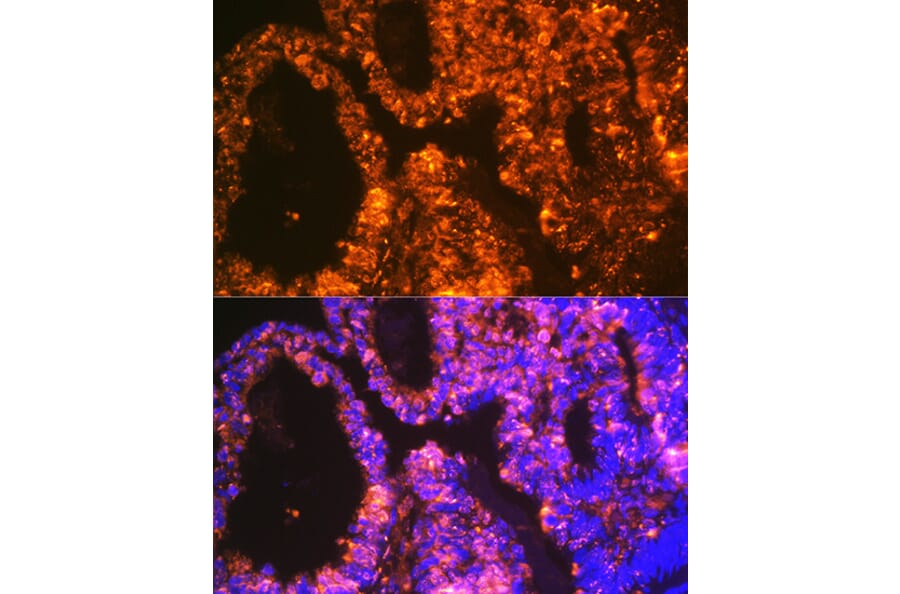 Immunofluorescence - Anti-LIN28A Antibody [ARC1668] (A329570) - Antibodies.com
