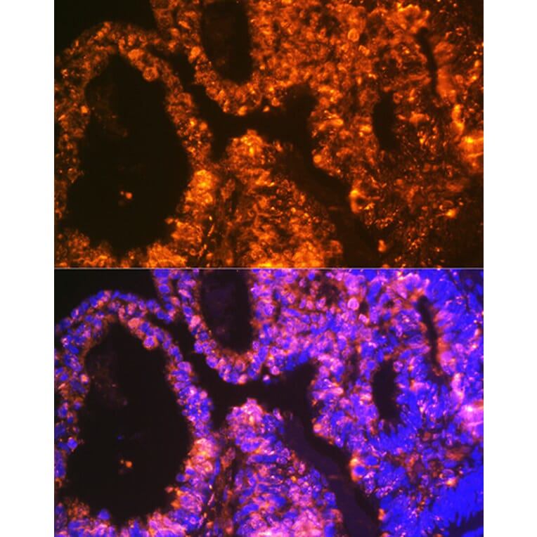 Immunofluorescence - Anti-LIN28A Antibody [ARC1668] (A329570) - Antibodies.com