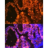 Immunofluorescence - Anti-LIN28A Antibody [ARC1668] (A329570) - Antibodies.com