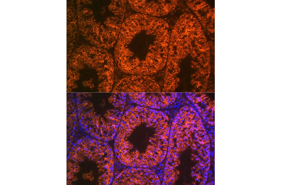 Immunofluorescence - Anti-LIN28A Antibody [ARC1668] (A329570) - Antibodies.com