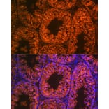 Immunofluorescence - Anti-LIN28A Antibody [ARC1668] (A329570) - Antibodies.com