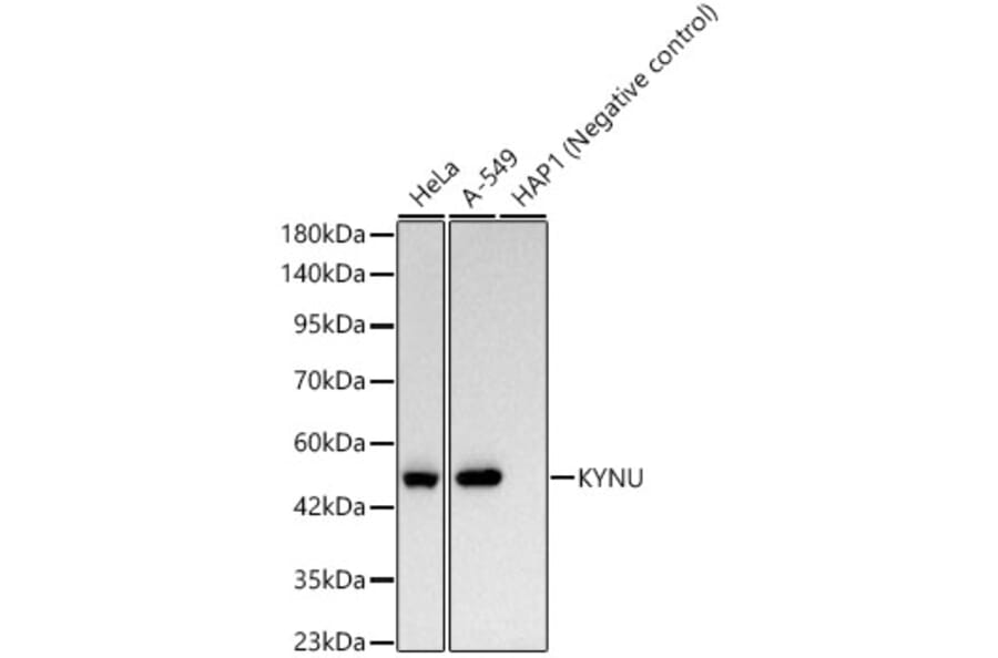 Western Blot - Anti-L-Kynurenine Hydrolase Antibody [ARC62786] (A329571) - Antibodies.com