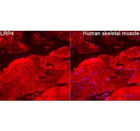 Immunofluorescence - Anti-LRP4 Antibody (A329574) - Antibodies.com