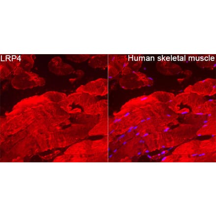 Immunofluorescence - Anti-LRP4 Antibody (A329574) - Antibodies.com
