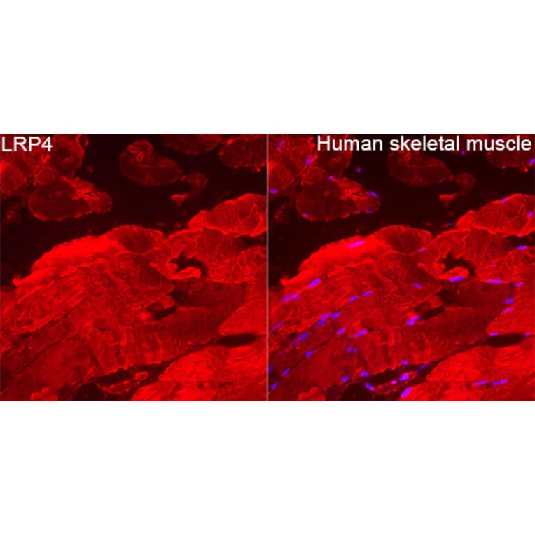 Immunofluorescence - Anti-LRP4 Antibody (A329574) - Antibodies.com