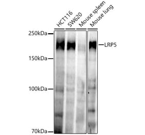 Western Blot - Anti-LRP5 Antibody [ARC52451] (A329575) - Antibodies.com