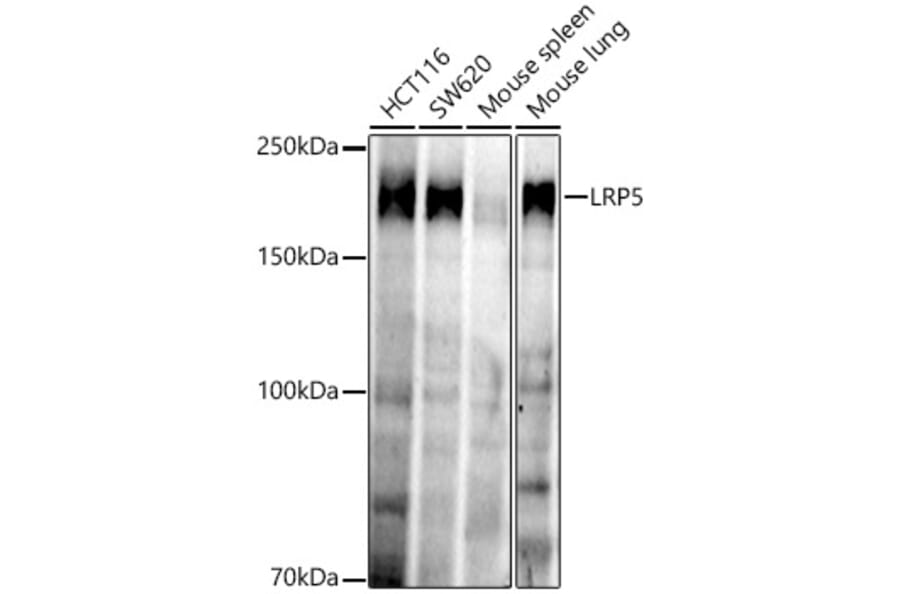 Western Blot - Anti-LRP5 Antibody [ARC52451] (A329575) - Antibodies.com