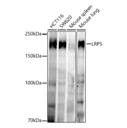Western Blot - Anti-LRP5 Antibody [ARC52451] (A329575) - Antibodies.com
