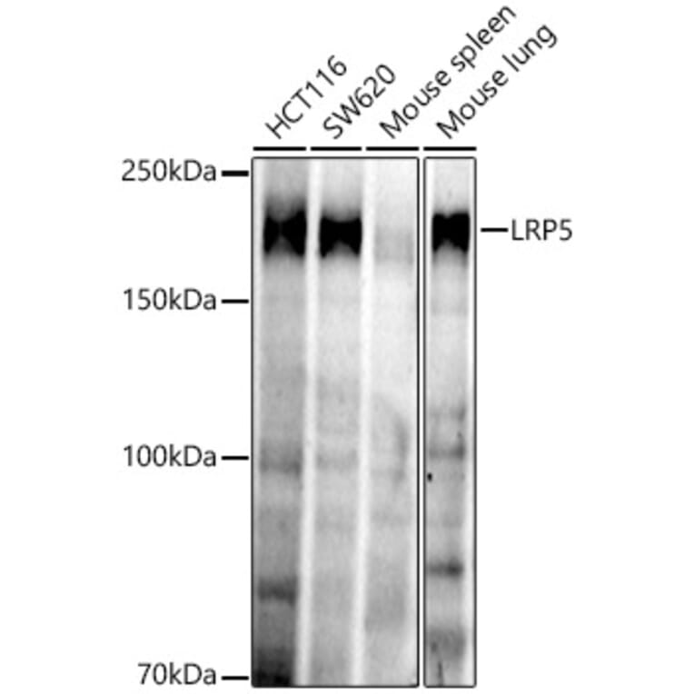 Western Blot - Anti-LRP5 Antibody [ARC52451] (A329575) - Antibodies.com